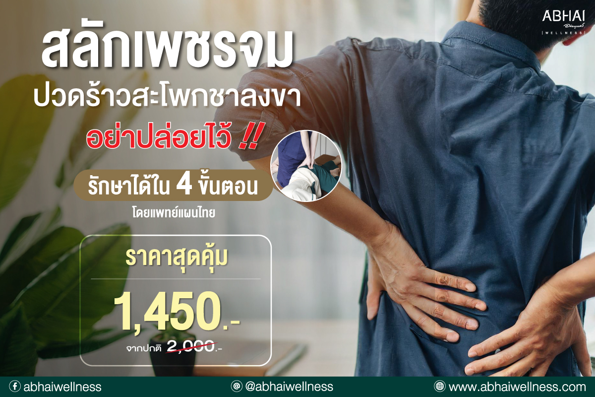 สลักเพชรจม (Piriformis Syndrome)